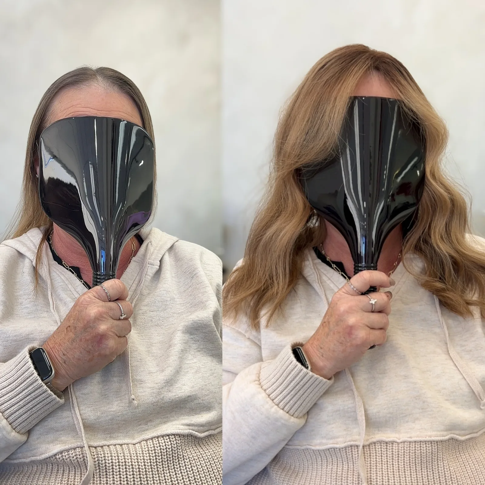 Custom hair replacement systems